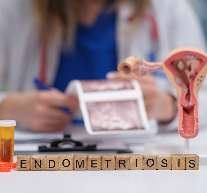 Endometriosis – Dr Genia Rozen fertility specialist