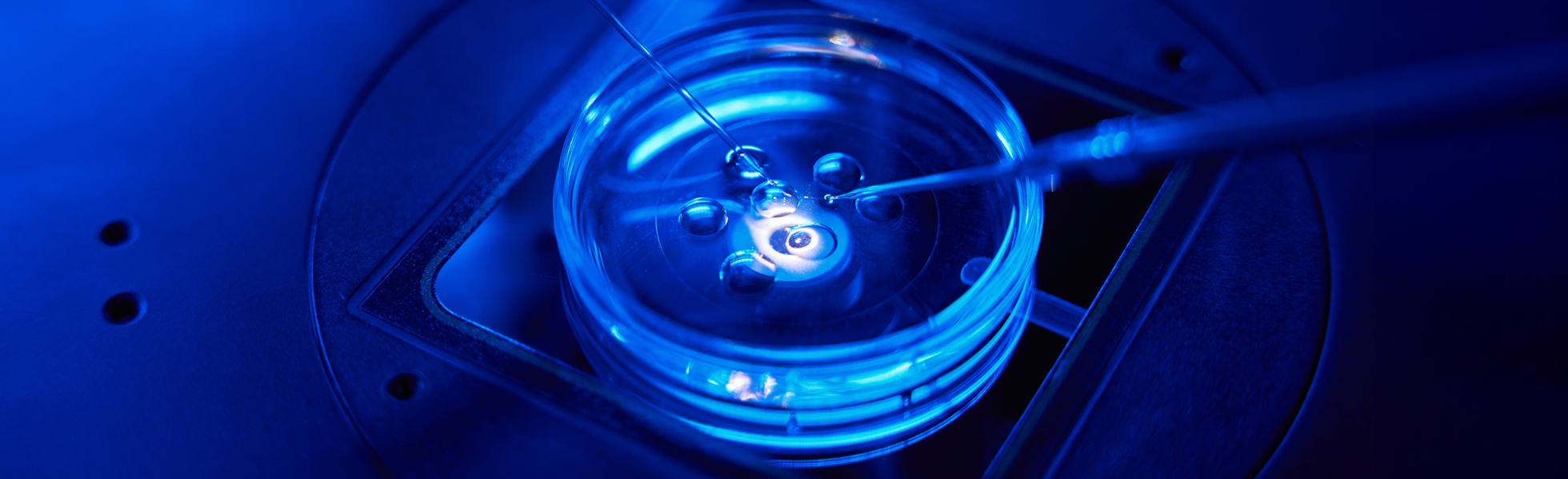 Intracytoplasmic Sperm Injection (ICSI)